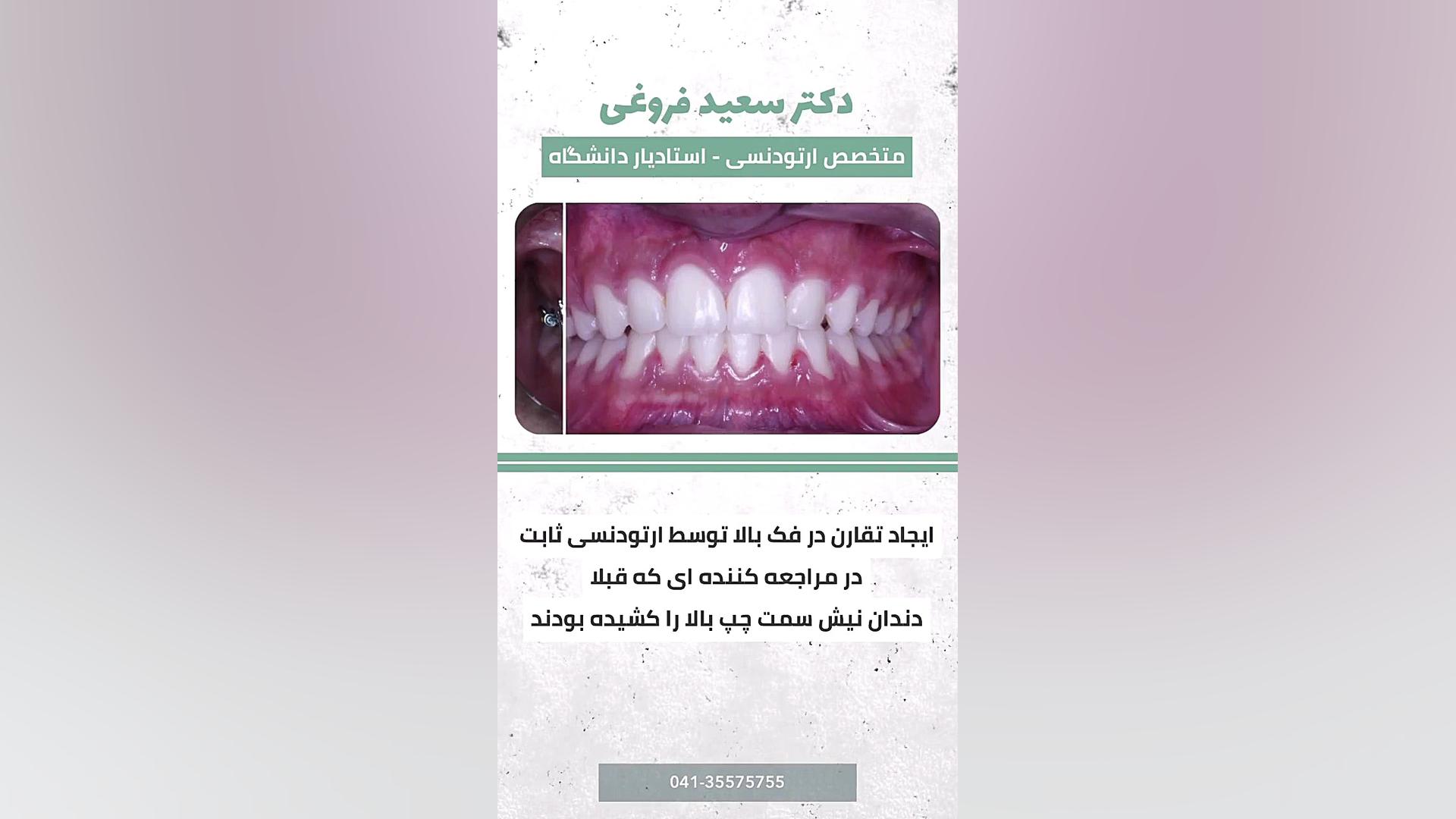 ارتودنسی دندان دکتر سعید فروغی متخصص ارتودنسی