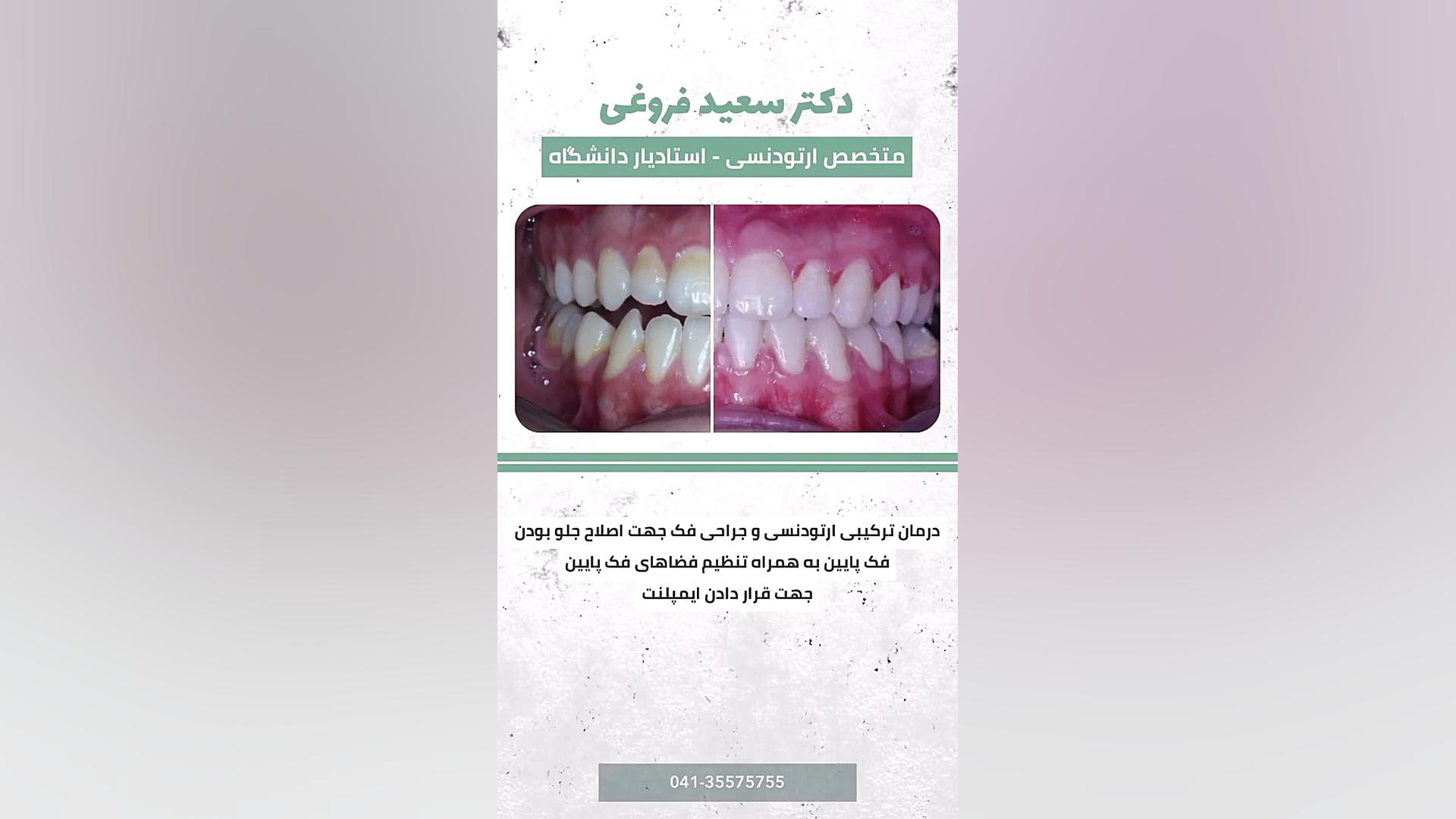 ارتودنسی دندان دکتر سعید فروغی متخصص ارتودنسی