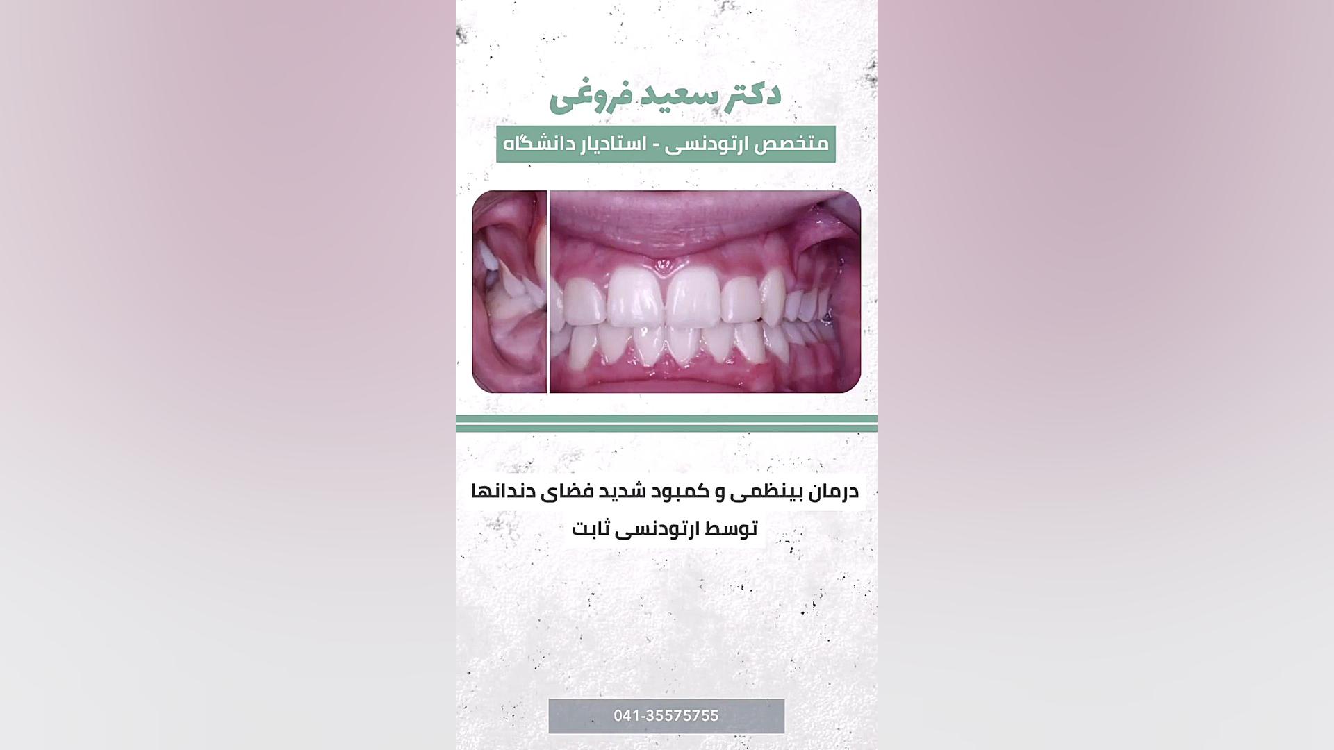 ارتودنسی دندان دکتر سعید فروغی متخصص ارتودنسی