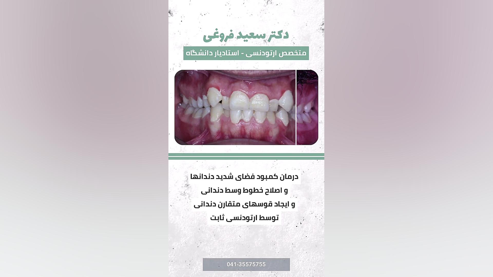ارتودنسی دندان دکتر سعید فروغی متخصص ارتودنسی