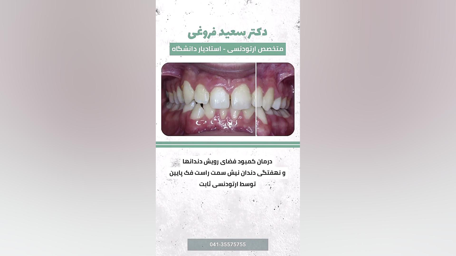 ارتودنسی دندان دکتر سعید فروغی متخصص ارتودنسی