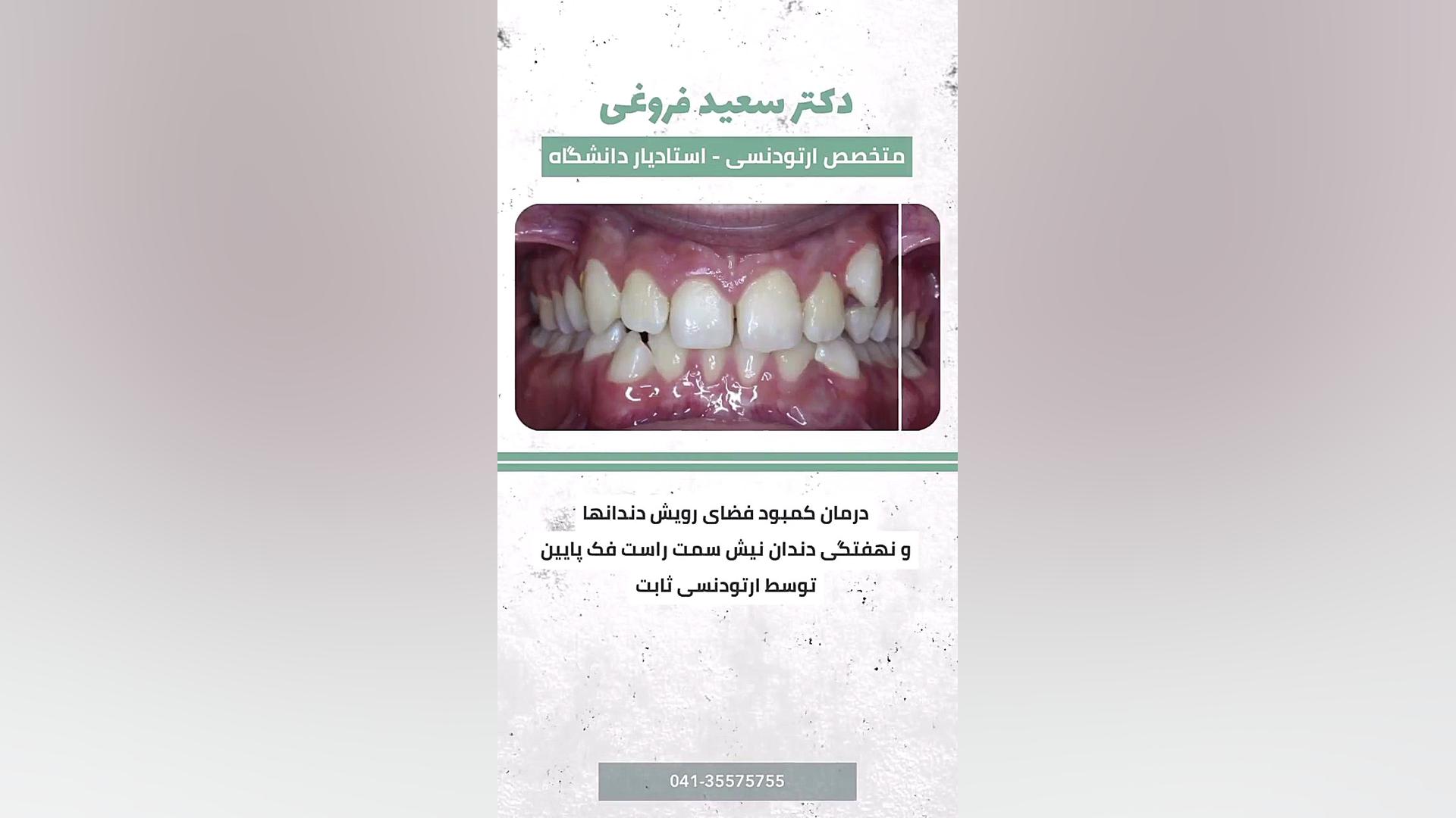 ارتودنسی دندان دکتر سعید فروغی متخصص ارتودنسی