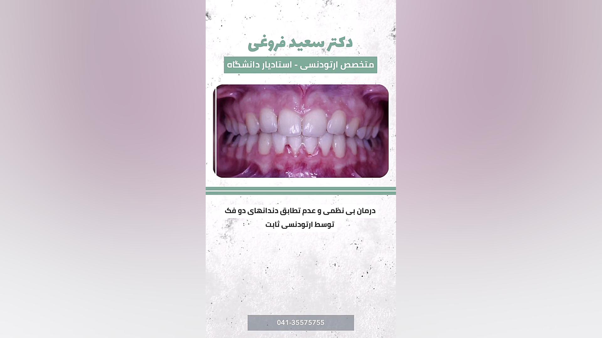 ارتودنسی دندان دکتر سعید فروغی متخصص ارتودنسی