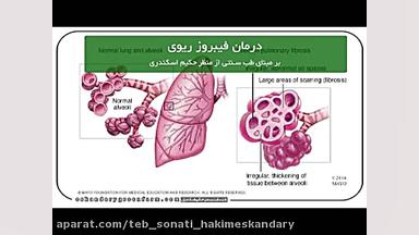 درمان فیبروز ریه در طب سنتی جراحی لثه