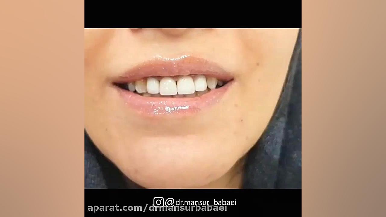تجربه لبخندی زیبا و به یاد ماندنی دکتر منصور بابایی