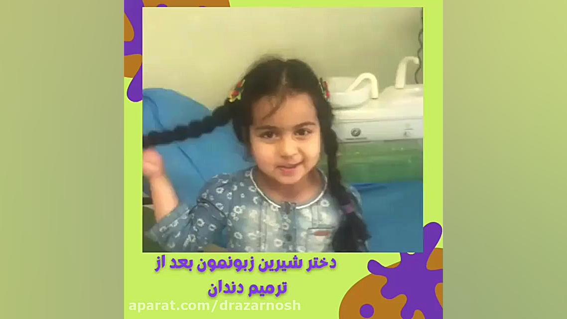 فیلم ترمیم دندان کودک V/Q Scan