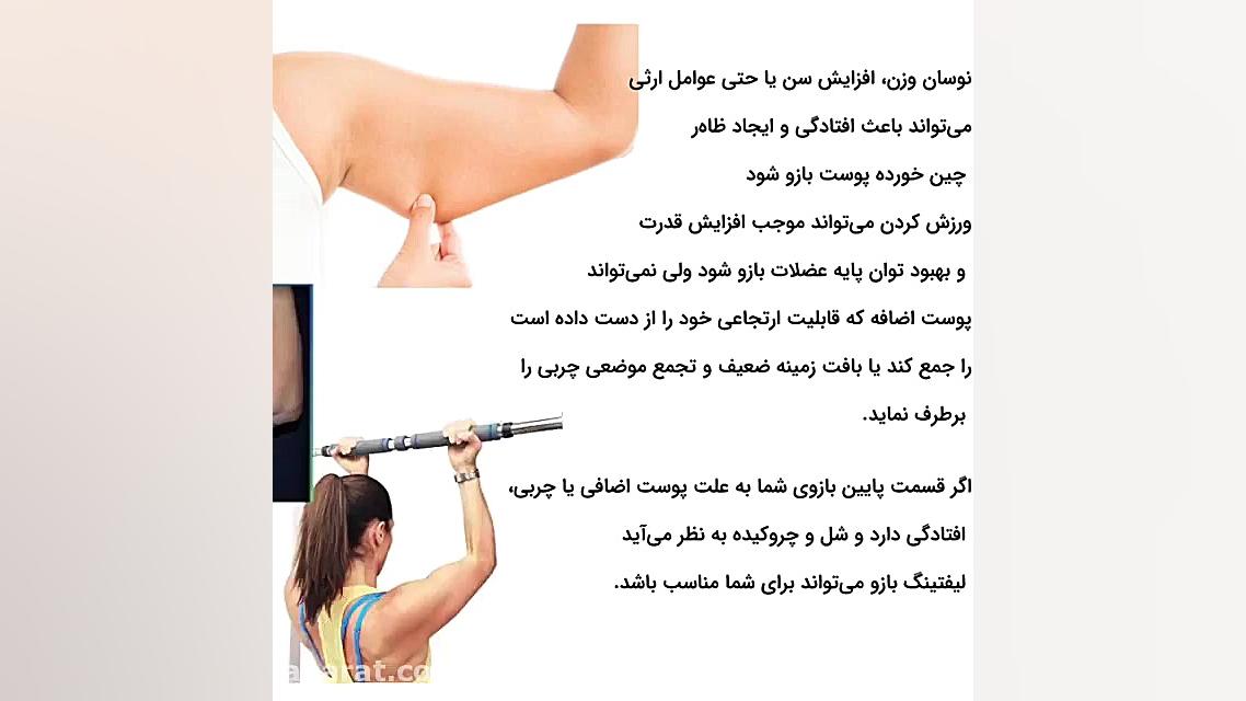 فیلم عمل لیفت بازو دکتر حمید رضا فتحی فوق تخصص جراحی پلاستیک