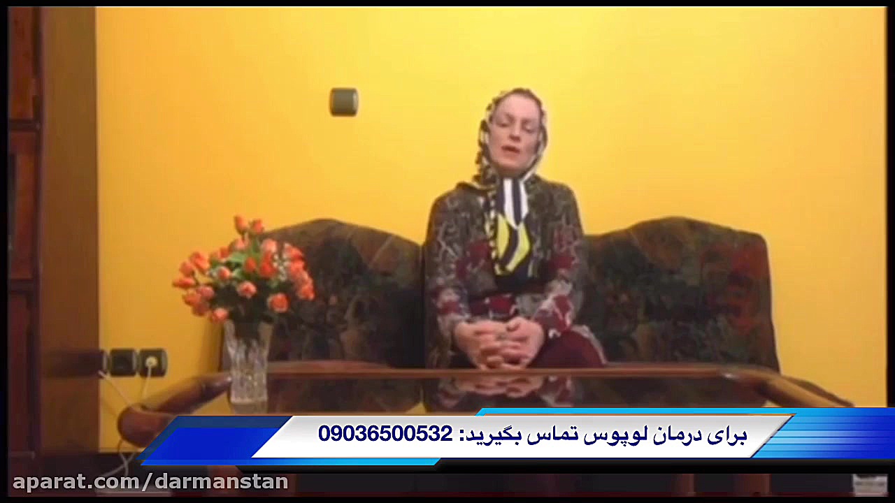 صحبت یکی از بیماران درمان شده لوپوس ترمیم دندان