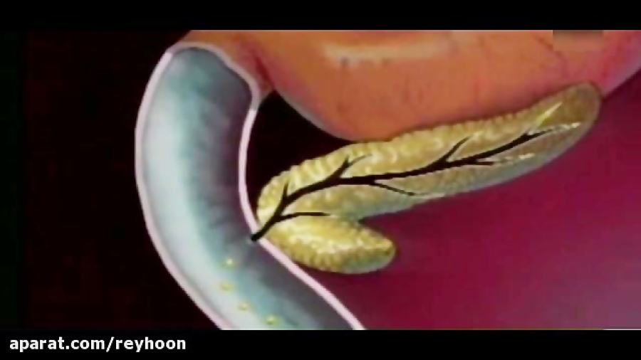دیابت وابسته به انسولین زیبایی پوست