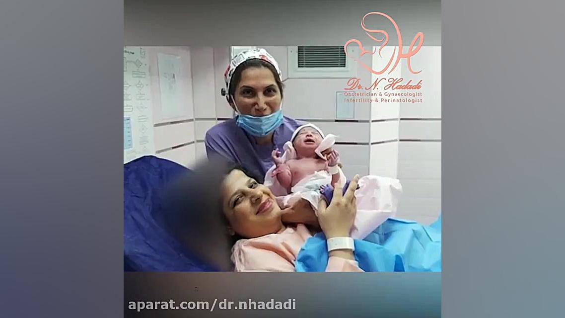 زایمان سزارین تیلا کوچولو درمان ریزش مو