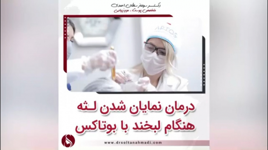 فیلم درمان لبخند لثه نما با تزریق بوتاکس ارنیزوماب