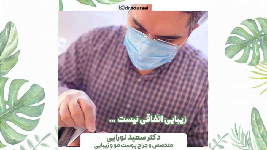درمان ریزش موی سکه ای دکتر سعید نورایی
