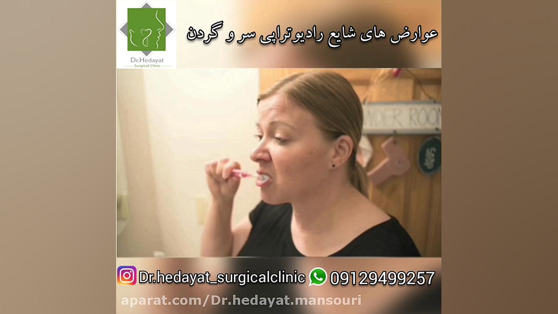 عوارض رادیوتراپی سر و گردن با دکتر هدايت منصوری کلینیک مو