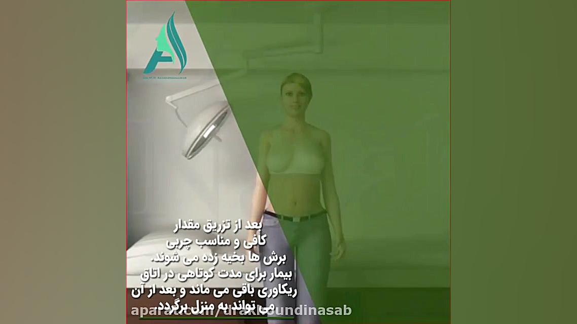مراحل تزریق چربی به سینه دکتر محمدرضا آخوندی نسب-فوق تخصص جراحی پلاستیک