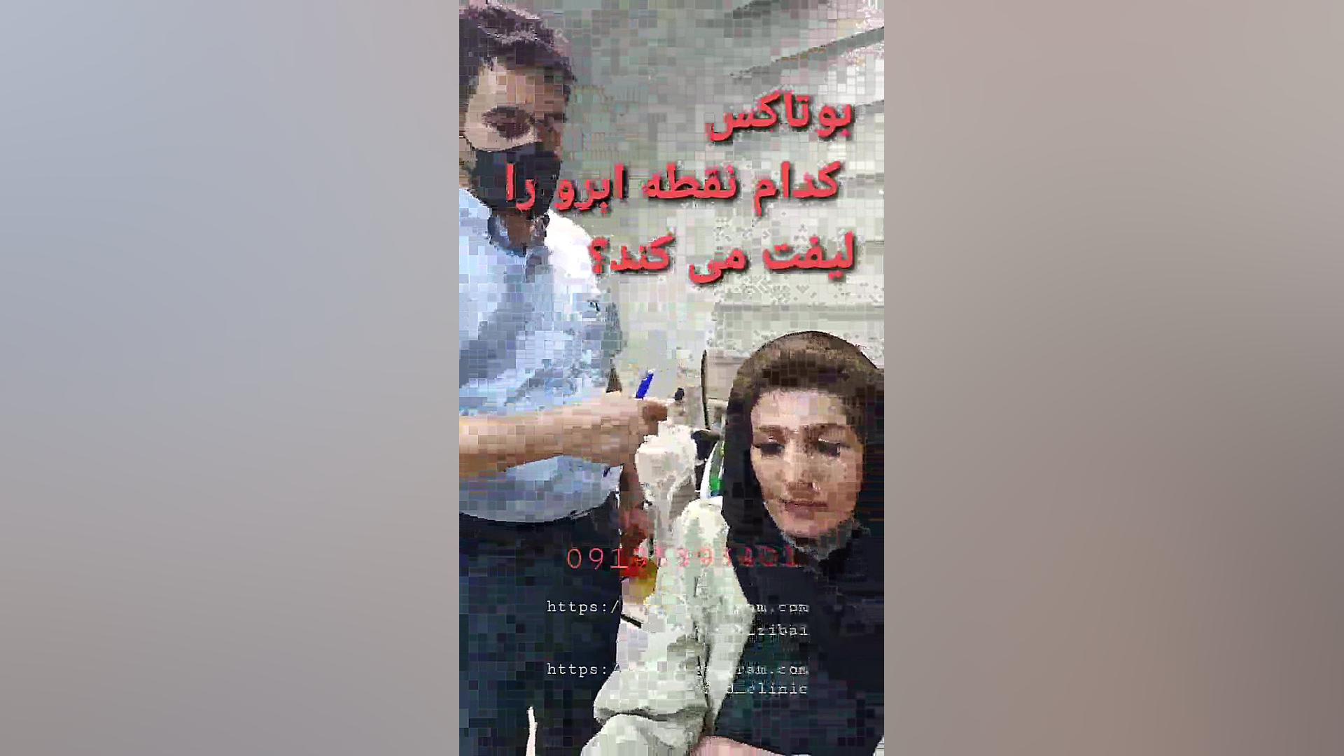 فیلم آموزش تزریق ژل بوتاکس پالپوتومی