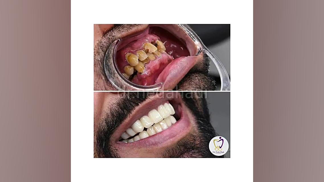 زیبای خفته دکتر ندا هادی-دندانپزشک زیبایی
