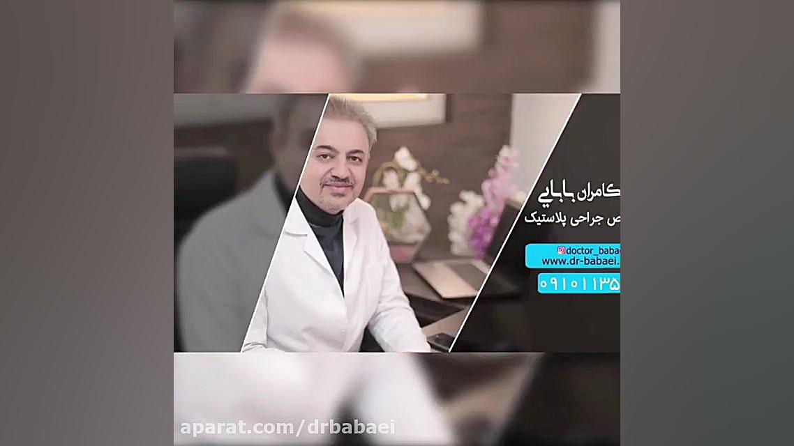 جراحی زیبایی بینی مردانه دکتر کامران بابایی