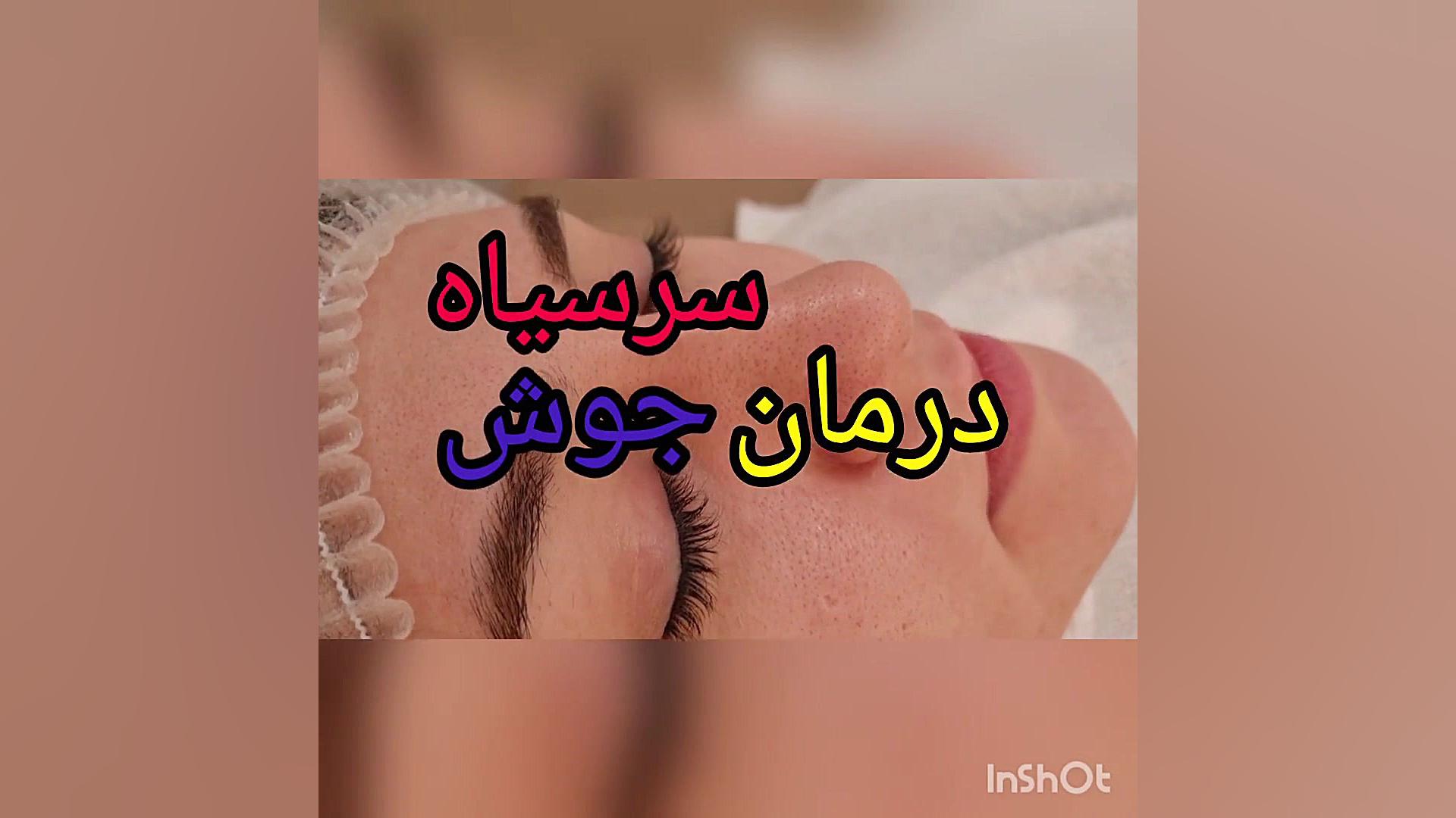 علی پور ۰۹۳۶۷۵۴۴۱۲۰ اینسایزینگ