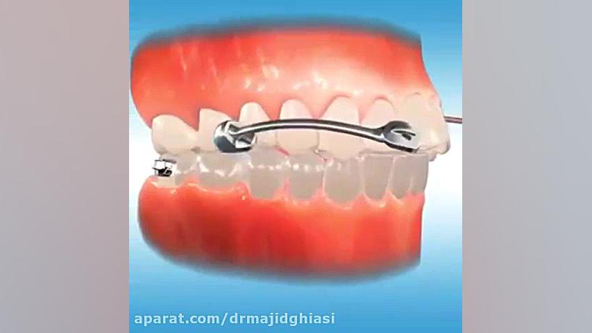 ارتودنسی دندان زیبایی دکترمجیدقیاسی