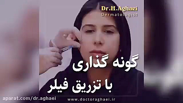 فیلم واقعی تزریق فیلر به گونه دکتر حمیده آقایی