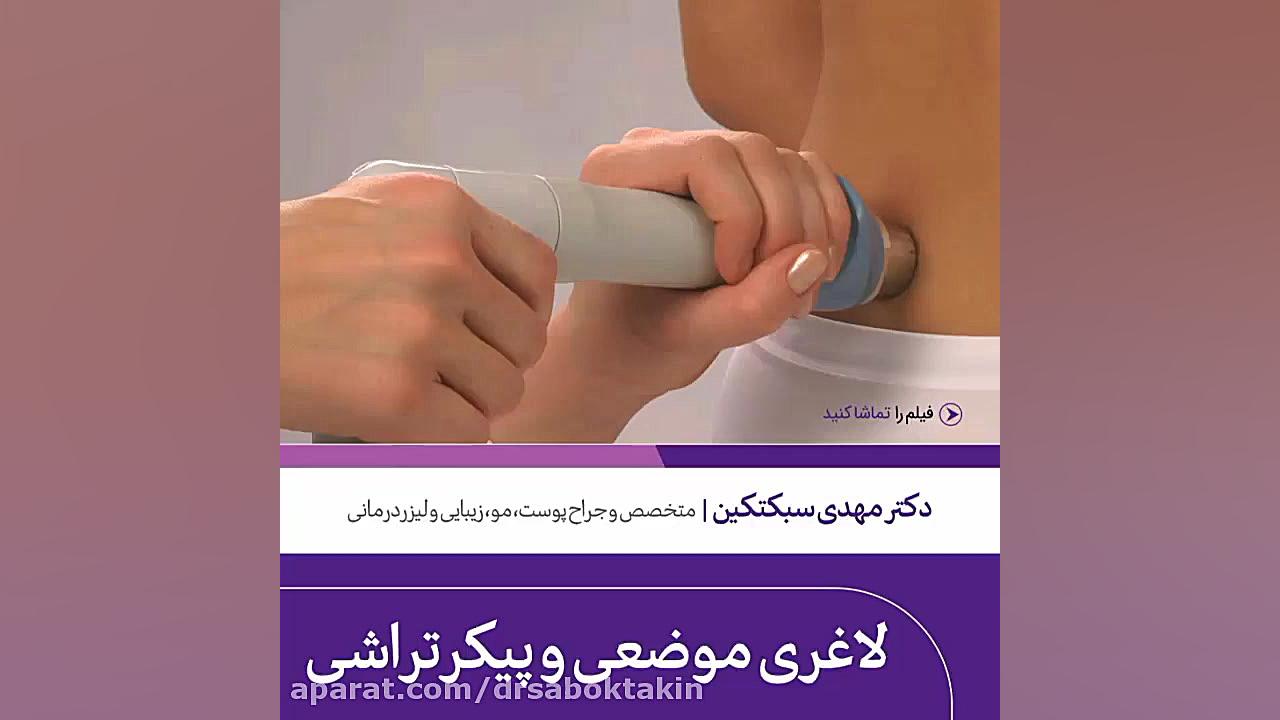 لاغری موضعی و پیکر تراشی در کلینیک دکتر سبکتکین متخصص پوست اصفهان متخصص پوست اصفهان دکتر مهدی سبکتکین