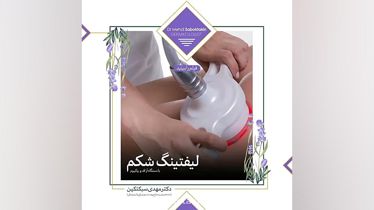 لیفتینگ شکم در کلینیک دکتر مهدی سبکتکین متخصص پوست اصفهان متخصص پوست اصفهان دکتر مهدی سبکتکین