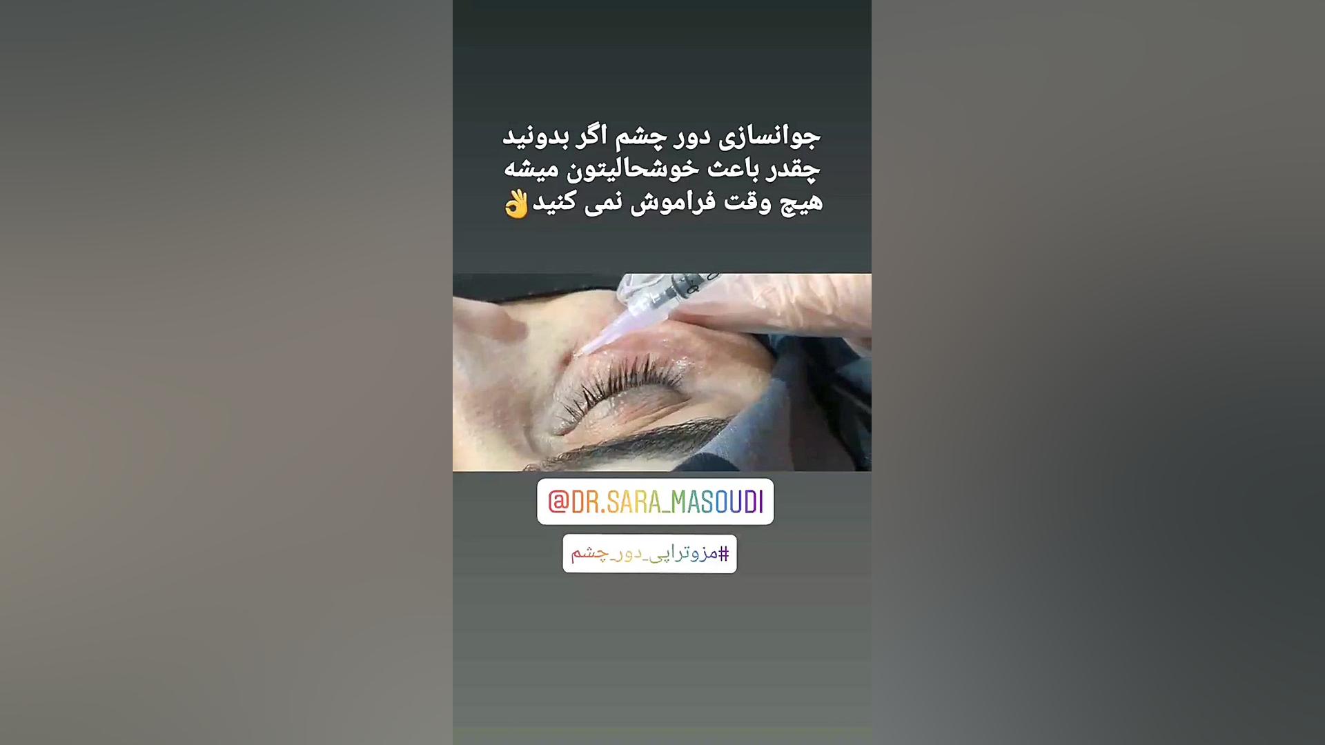 مزوتراپی دور چشم Autophagy Detection Kit