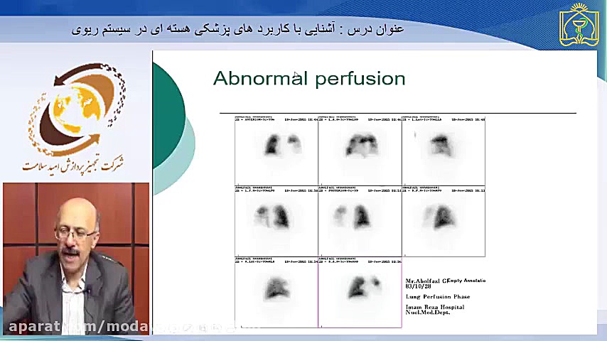 آشنایی با کاربرد های پزشکی هسته ای در بیماری های ریوی اینسایزینگ