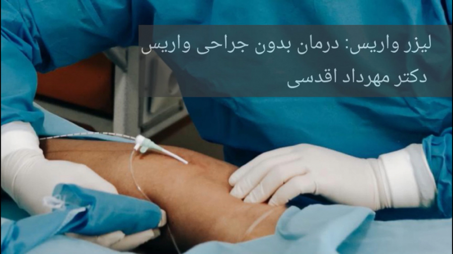 فیلم لیزر واریس: کلینیک واریس دکتر اقدسی لنز تماسی دارورسان