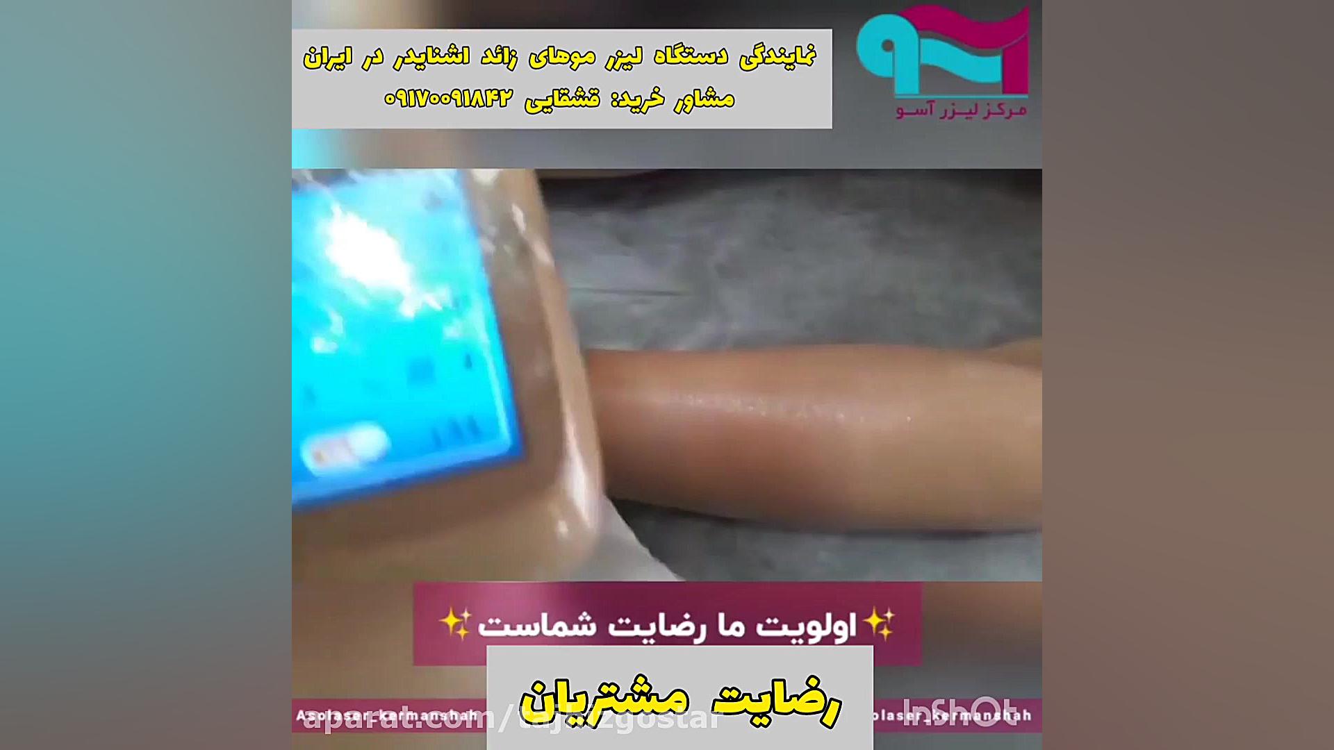 رضایت مشتری از دستگاه لیزر موهای زائد اشنایدر schneider ایمونولوژی محاسباتی