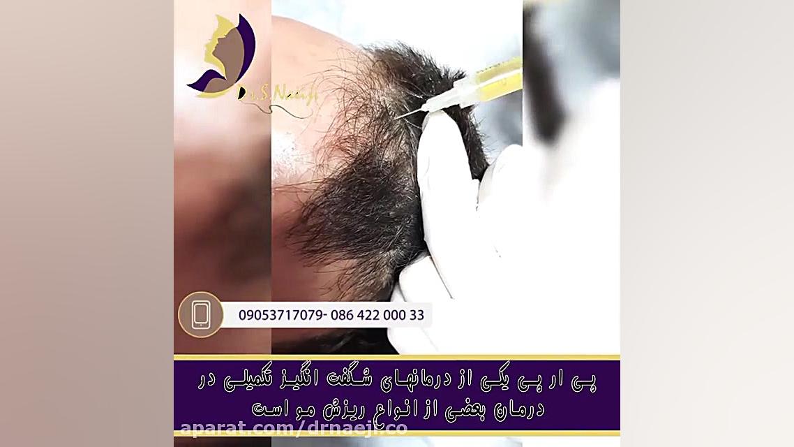 فیلم بدون سانسور تزریق پی آر پی در ساوه دکتر صدیقه نائیجی | متخصص پوست و مو در قم