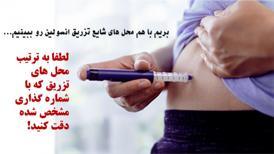 محل های تزریق انسولین رادیوگرافی دندان