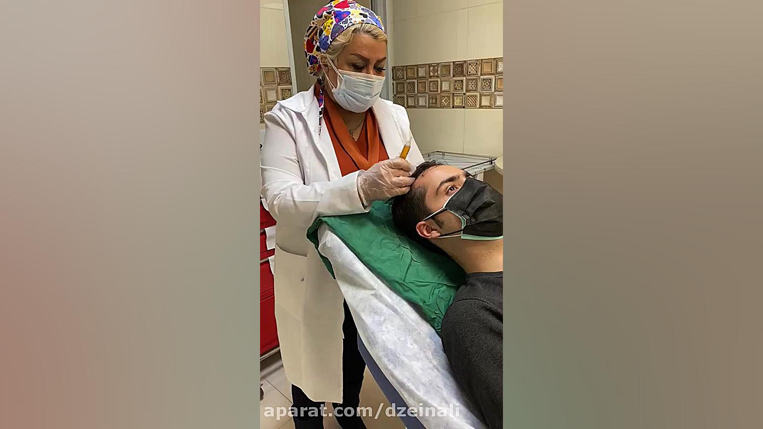 انجام prp به منظور درمان ریزش مو دکتر فرحناز زینعلی - متخصص پوست، مو، زیبایی زنجان