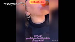 کلینیک چهره نو انزلی