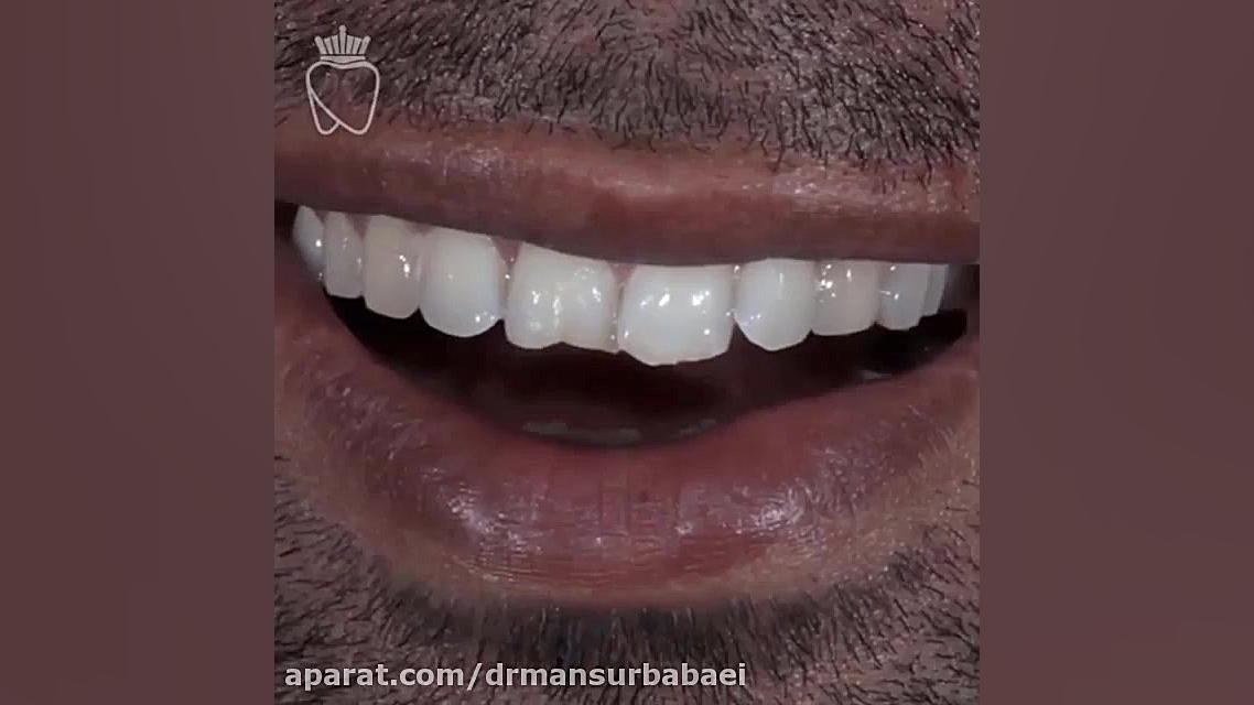 خلق لبخندی زیبا، برای شما زیبایی دوستان دکتر منصور بابایی