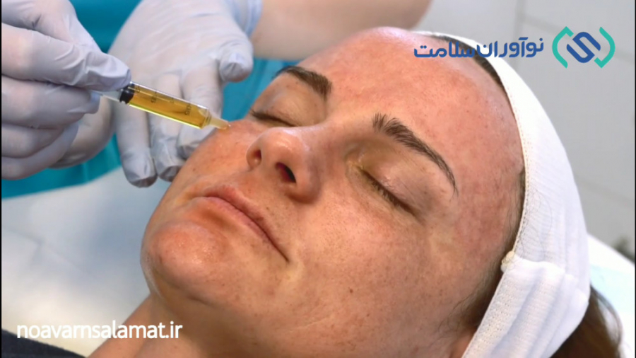 تاثیر مزونیدلینگ در جوانسازی پوست چیست - نوآوران سلامت PEFR