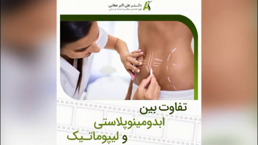 فرق بین ابدومینوپلاستی و لیپوماتیک چیست؟ کاشت ریش