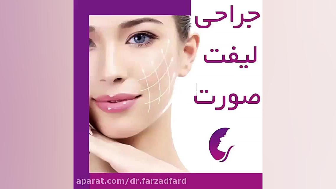 جراحی لیفت صورت توسط دکتر اسماعیل فرزادفرد لوسارتان