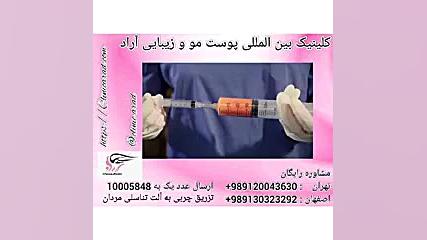 تزریق چربی به الت تناسلی اقایان اصلاح فرم صورت