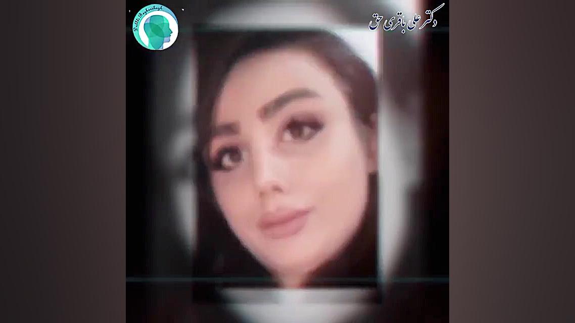 قبل و بعد جراحی بینی دکتر علی باقری حق