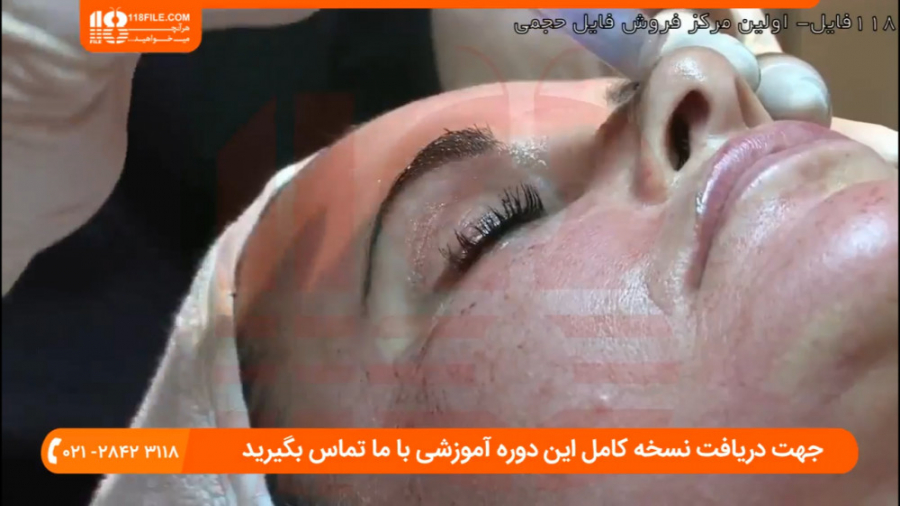 آموزش پاکسازی صورت | آموزش فیشیال پوست | پاکسازی پوست ( آموزش میکرونیدلینگ ) دستگاه فیبر نوری جراحی