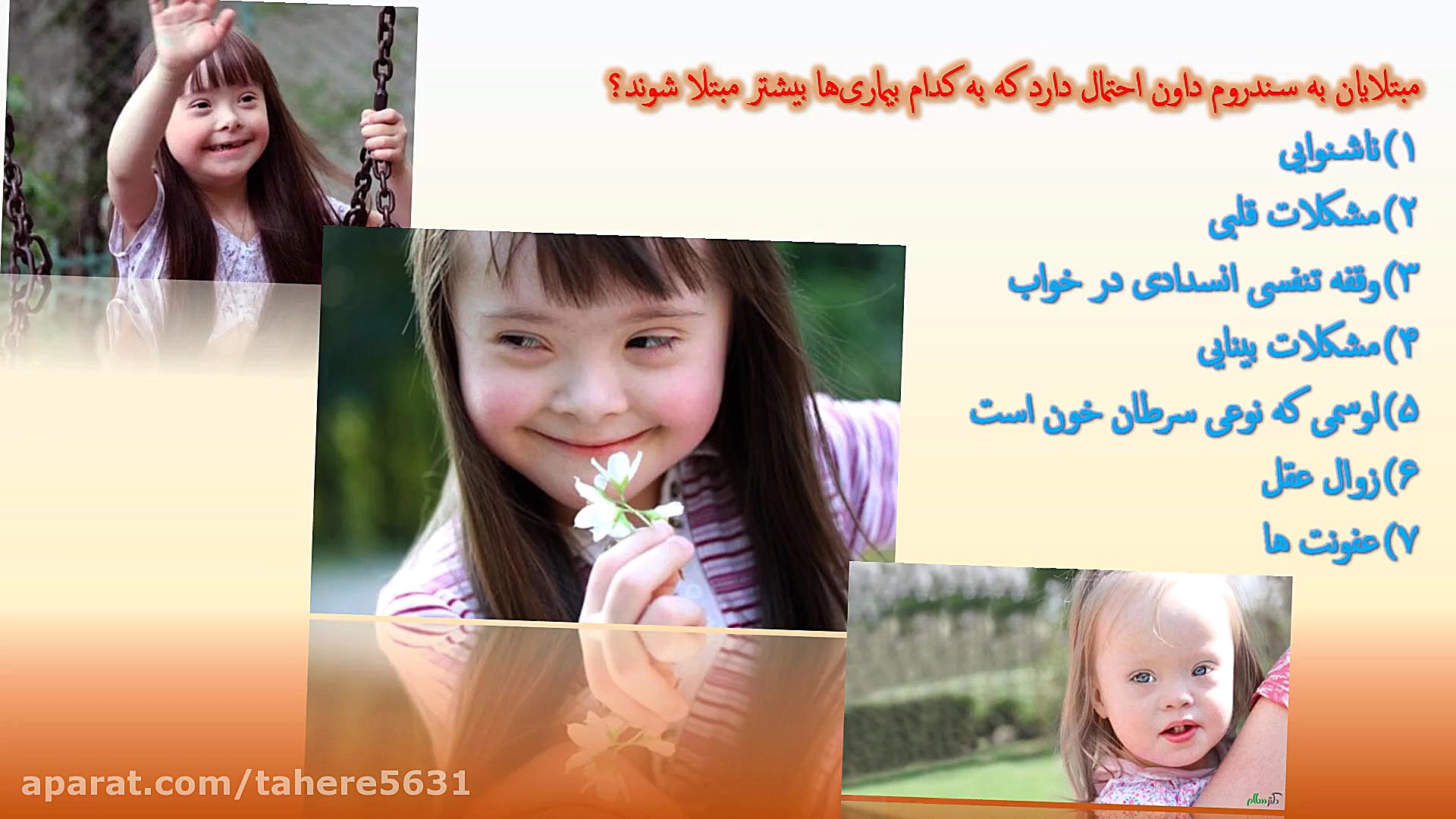 سندروم داون کاری از آوینا بدران و آرمیتا کیانی نپتوکلیب