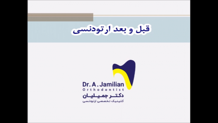قبل و بعد درمان ارتودنسی توسط دکتر جمیلیان / متخصص ارتودنسی دکتر عبدالرضا جمیلیان - متخصص ارتودنسی