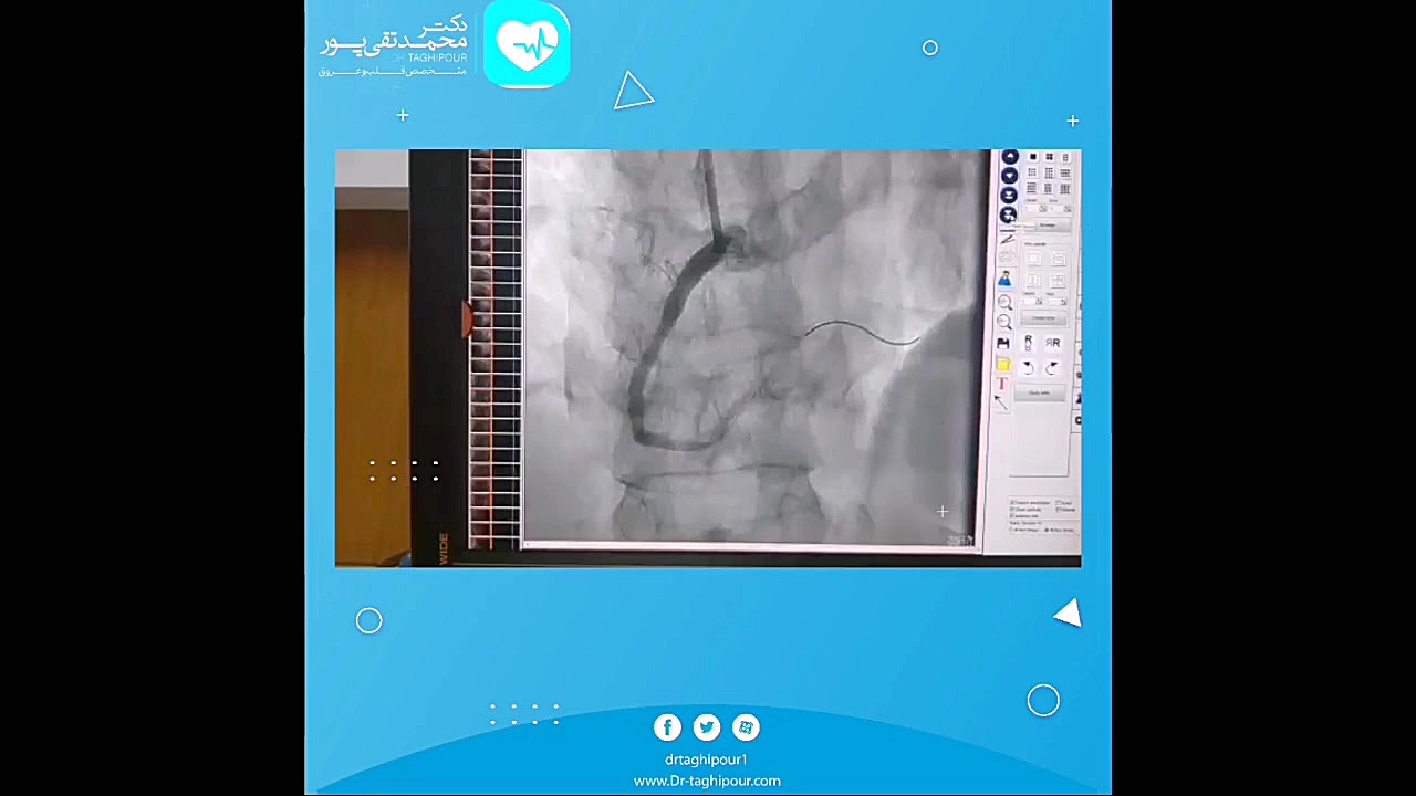 اهمیت قرص پلاویکس پاکسازی پوست
