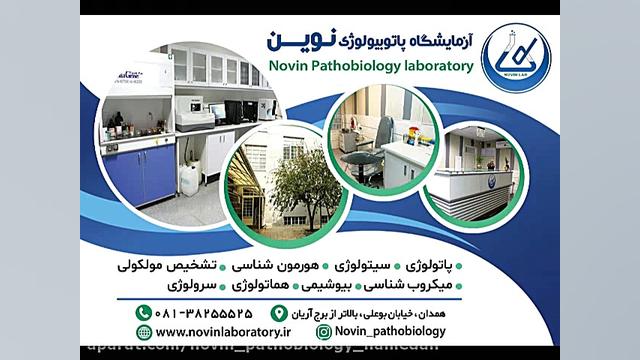 آزمایش تشخیصی اچ آی وی آزمایشگاه پاتوبیولوژی نوین همدان