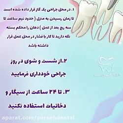 مراقبت های لازم بعد از جراحی دندان (قسمت اول)
