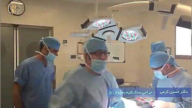 جراحی سنگ کلیه به روش باز اصلاح فرم صورت