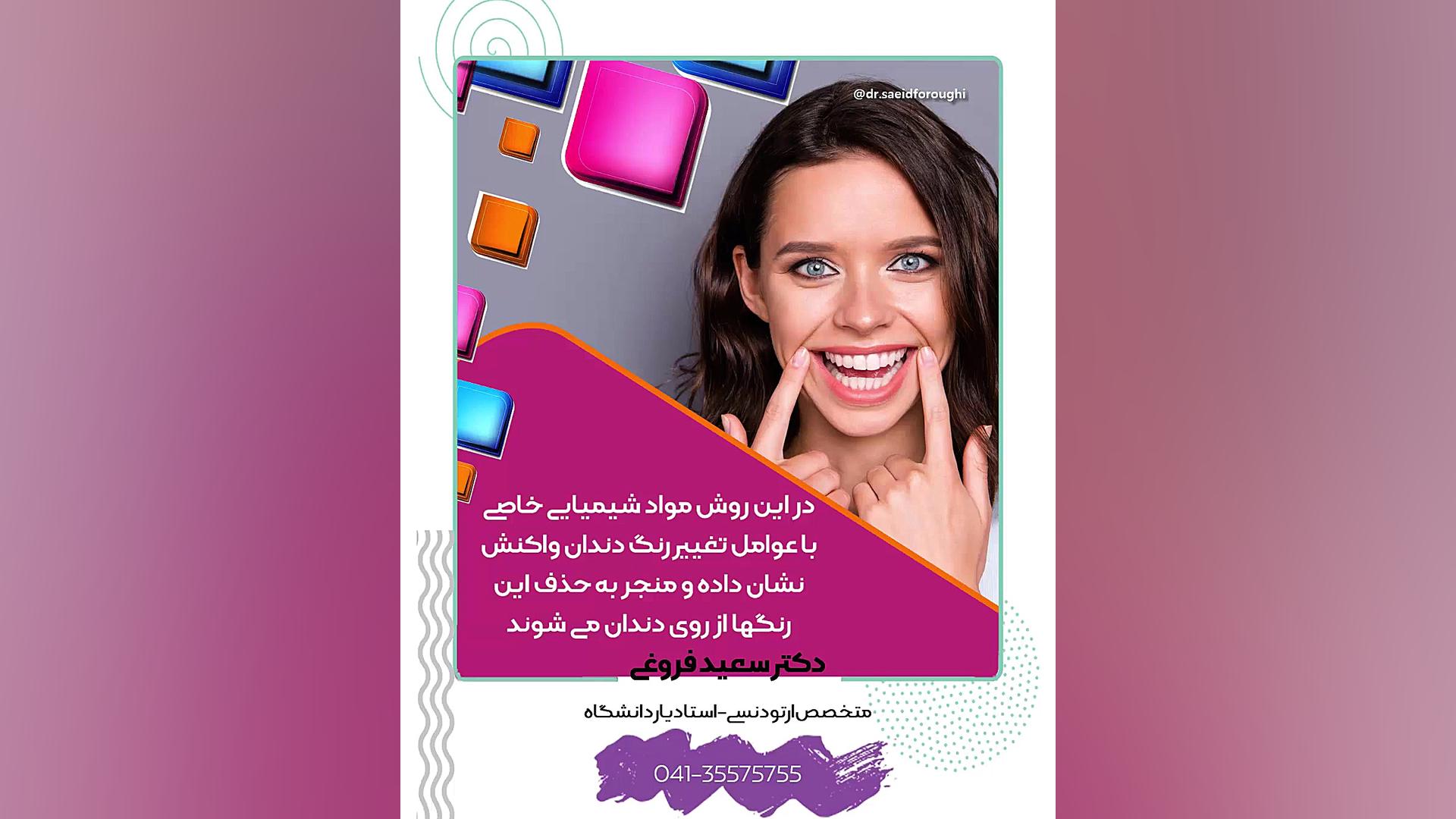 بلیچینگ دندان پزشکی کوهستان