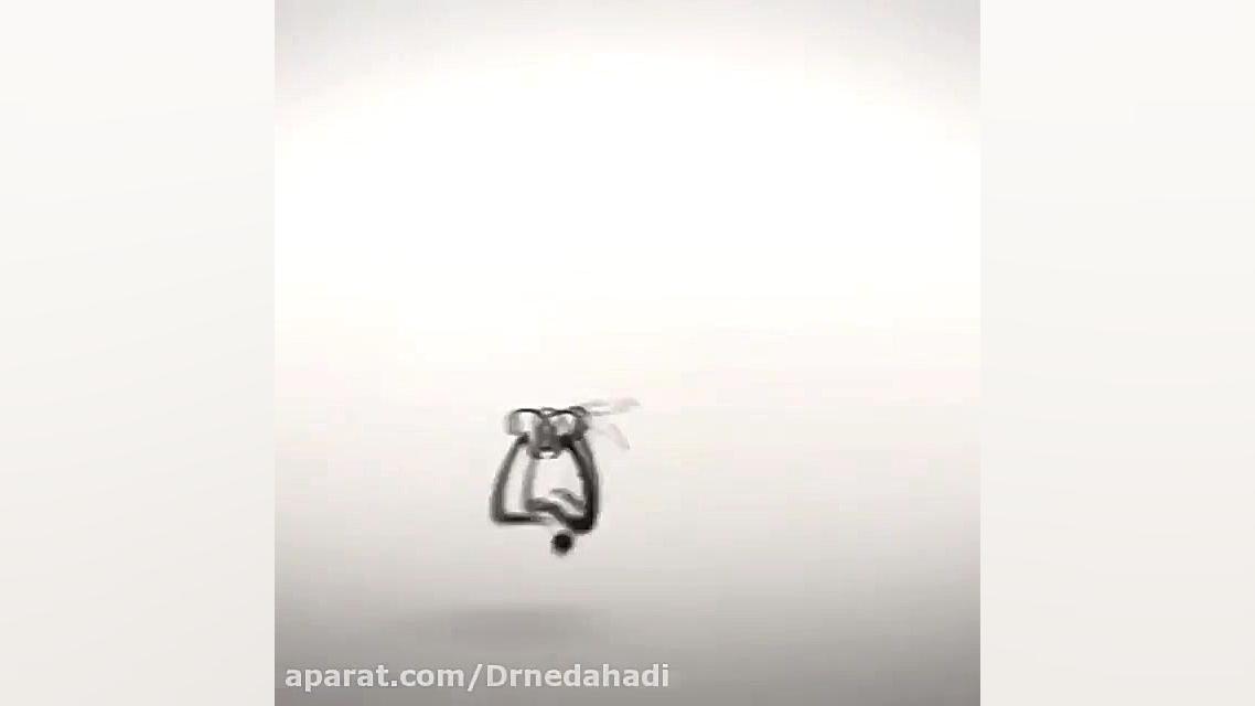 دندانپزشكى زیبایی بدون درد و استرس دکتر ندا هادی-دندانپزشک زیبایی