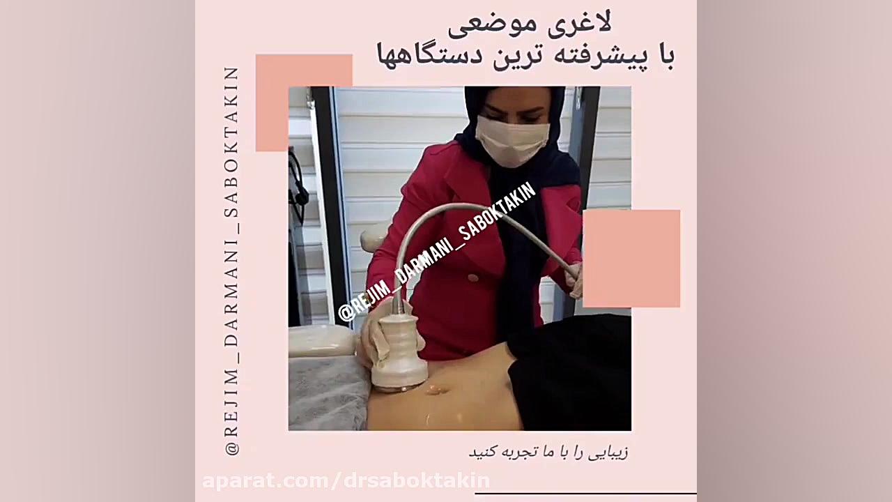 لاغری موضعی با دستگاه کویتیشن متخصص پوست اصفهان دکتر مهدی سبکتکین